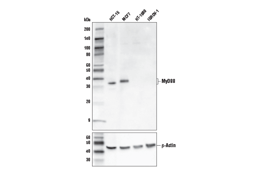 Western blot analysis of extracts from various cell lines using MyD88 (E9K4E) Mouse mAb (upper) or β-Actin (D6A8) Rabbit mAb #8457 (lower)